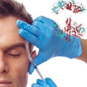 botox-injections