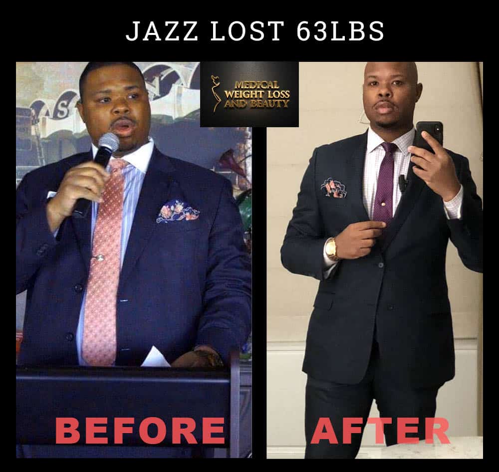 Before and After Image: Weight Loss - front
