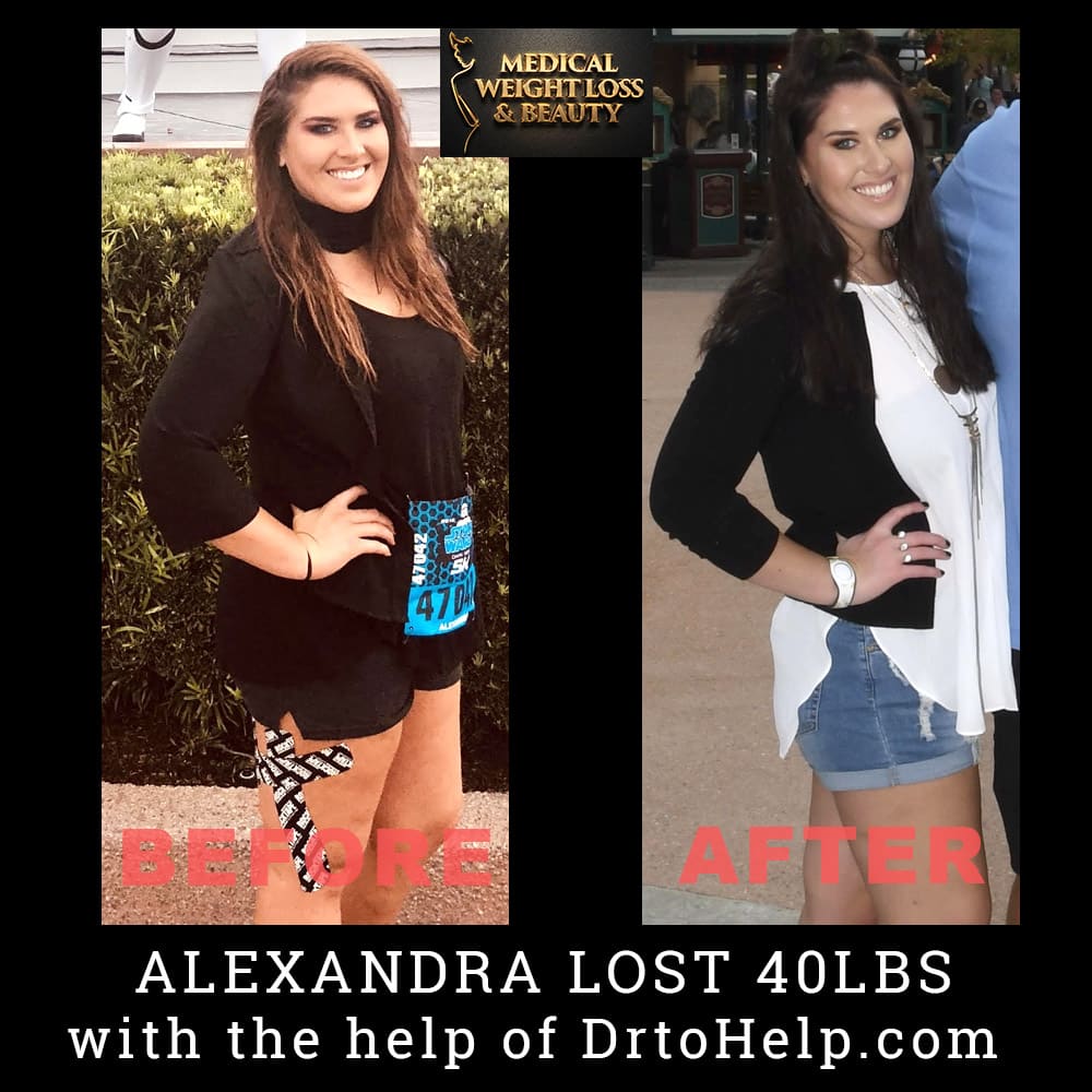 Before and After Image: Weight Loss - front