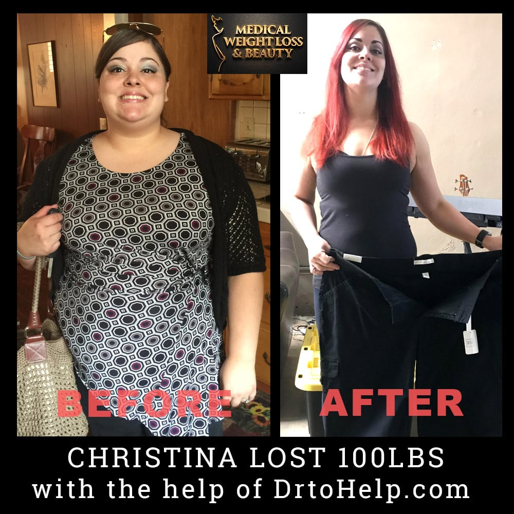 Before and After Image: Weight Loss - front