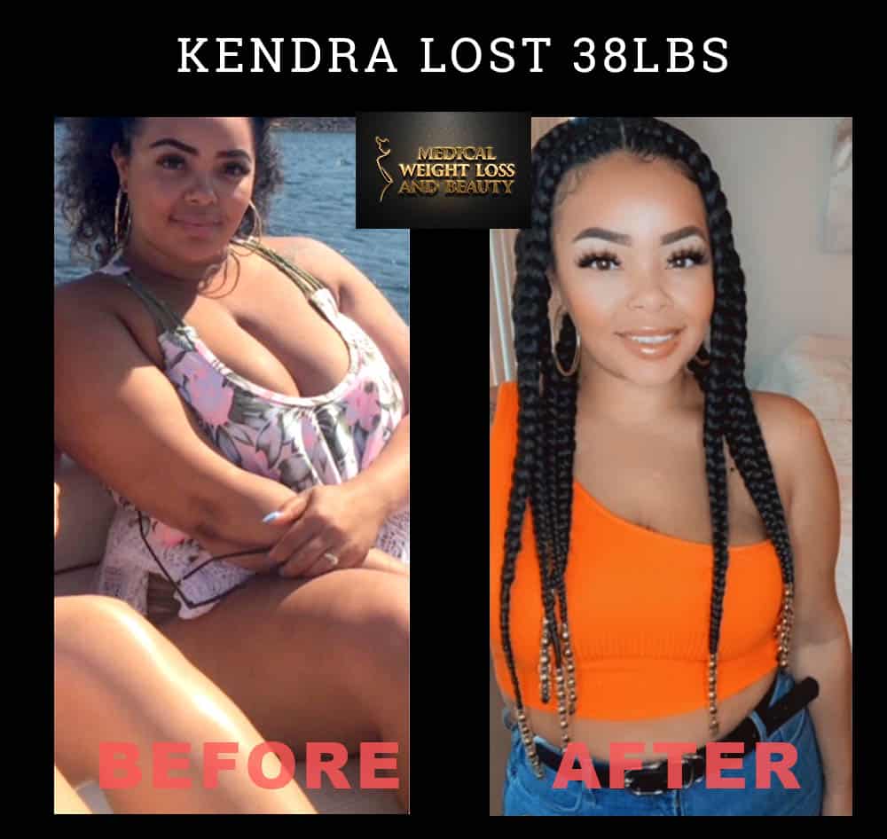 Before and After Image: Weight Loss - front