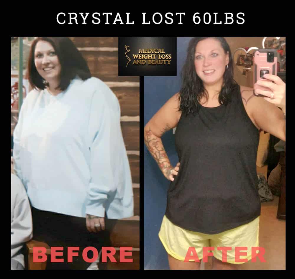 Before and After Image: Weight Loss - front