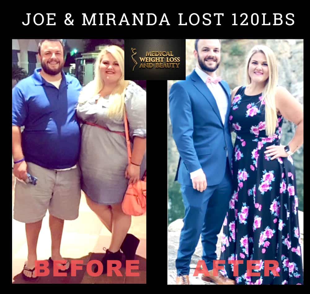 Before and After Image: Weight Loss - front