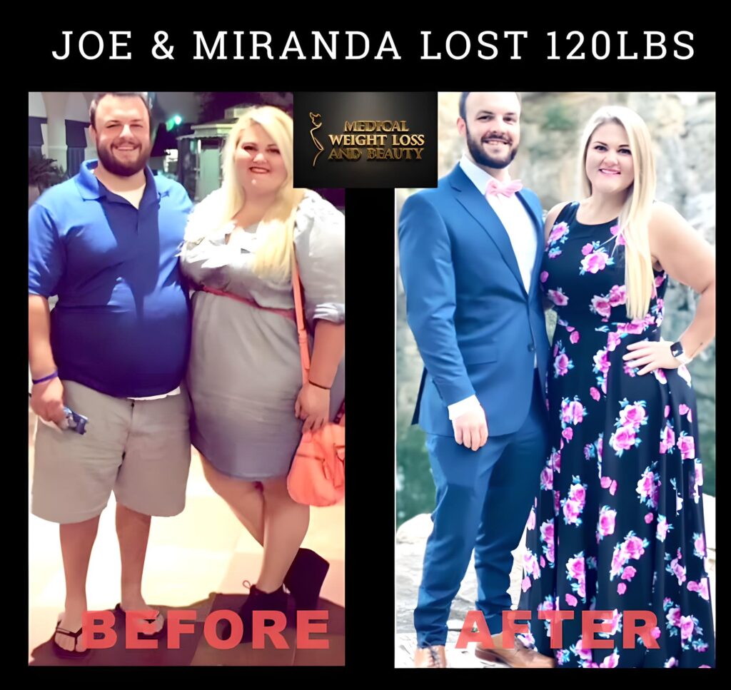 Joe-Miranda-S-weight-loss-patients-of-doctor-kojian