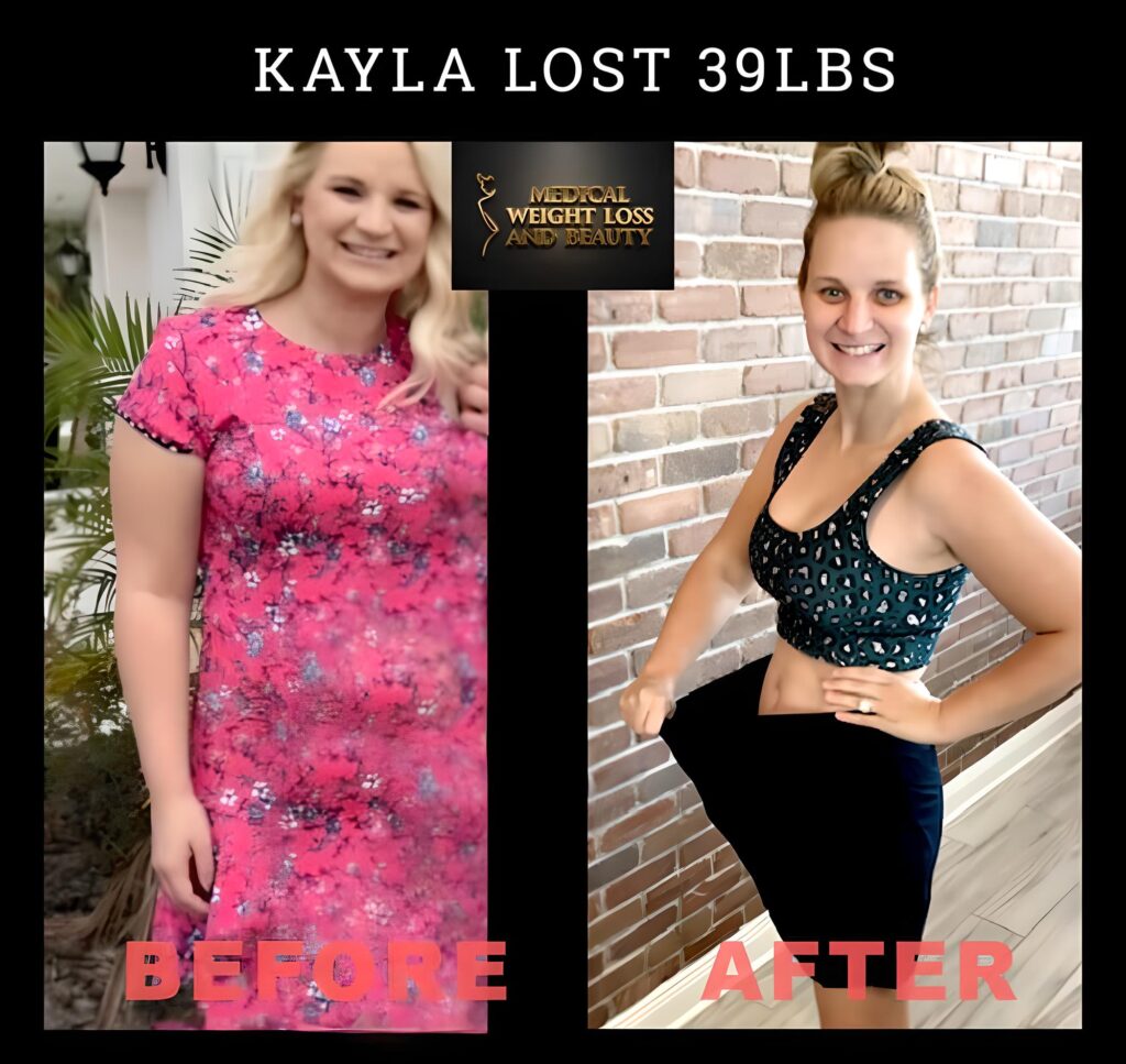 Kayla-H-huge-weight-loss-results