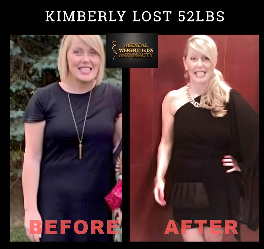 Kimberly-B
