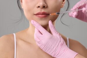 Close up of a woman receiving lip fillers for a fuller, more even smile after a lip augmentation